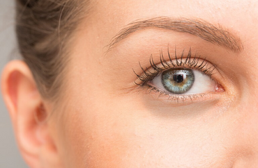 How to deal with Dark Circles and Under-Eye Bags?